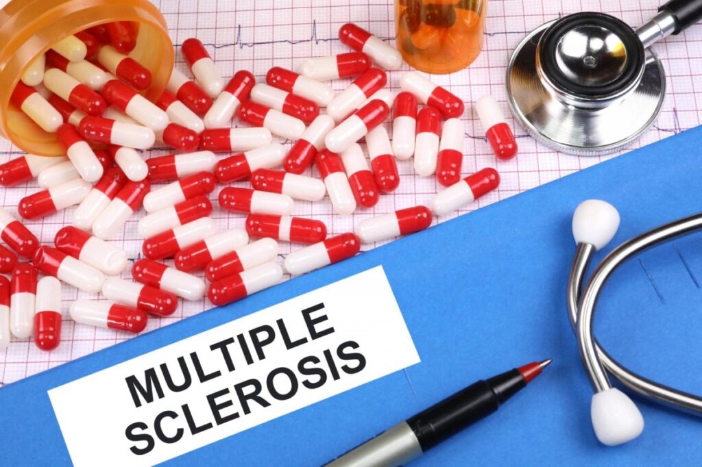 Multiple Sclerosis Treatment