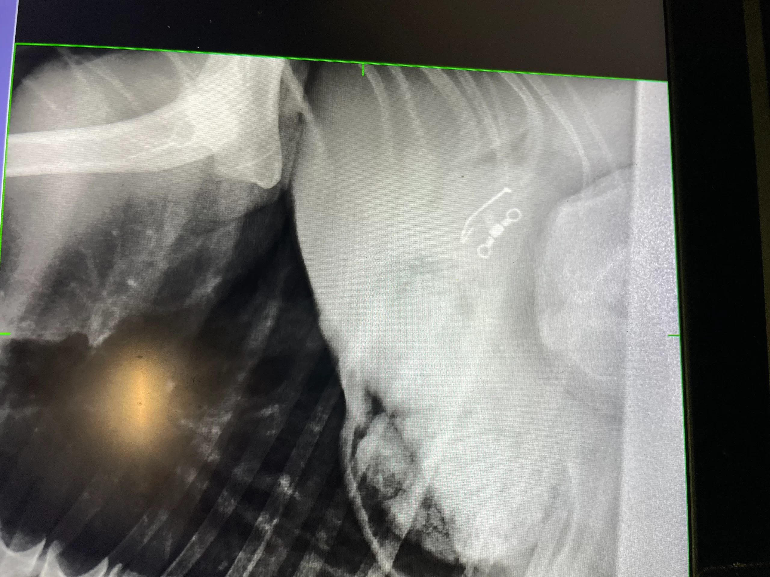 Dog Swallows Fishing Hook